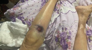 Ankara'da iki ay önce darp edildiği öne sürülen yaşlı kadın hastanede öldü