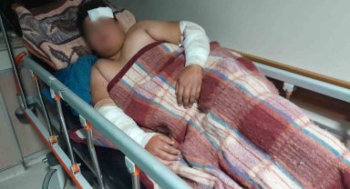 Konya'da köpeklerin kovaladığı çocuk bisikletten düşüp yaralandı