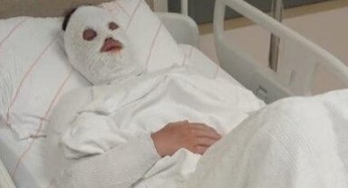 Eski nişanlısına kimyasal sıvı atan kişiye 15 yıl hapis cezası